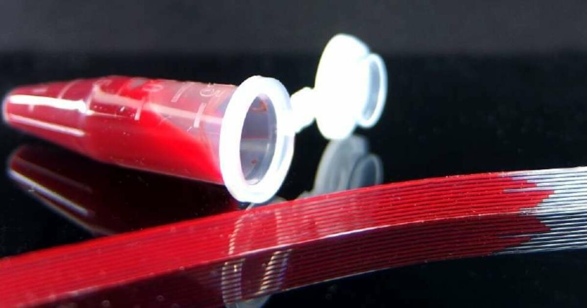 Minitest toont antibioticaresistentie voor effectieve Change Inc.