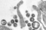 Lassa virus